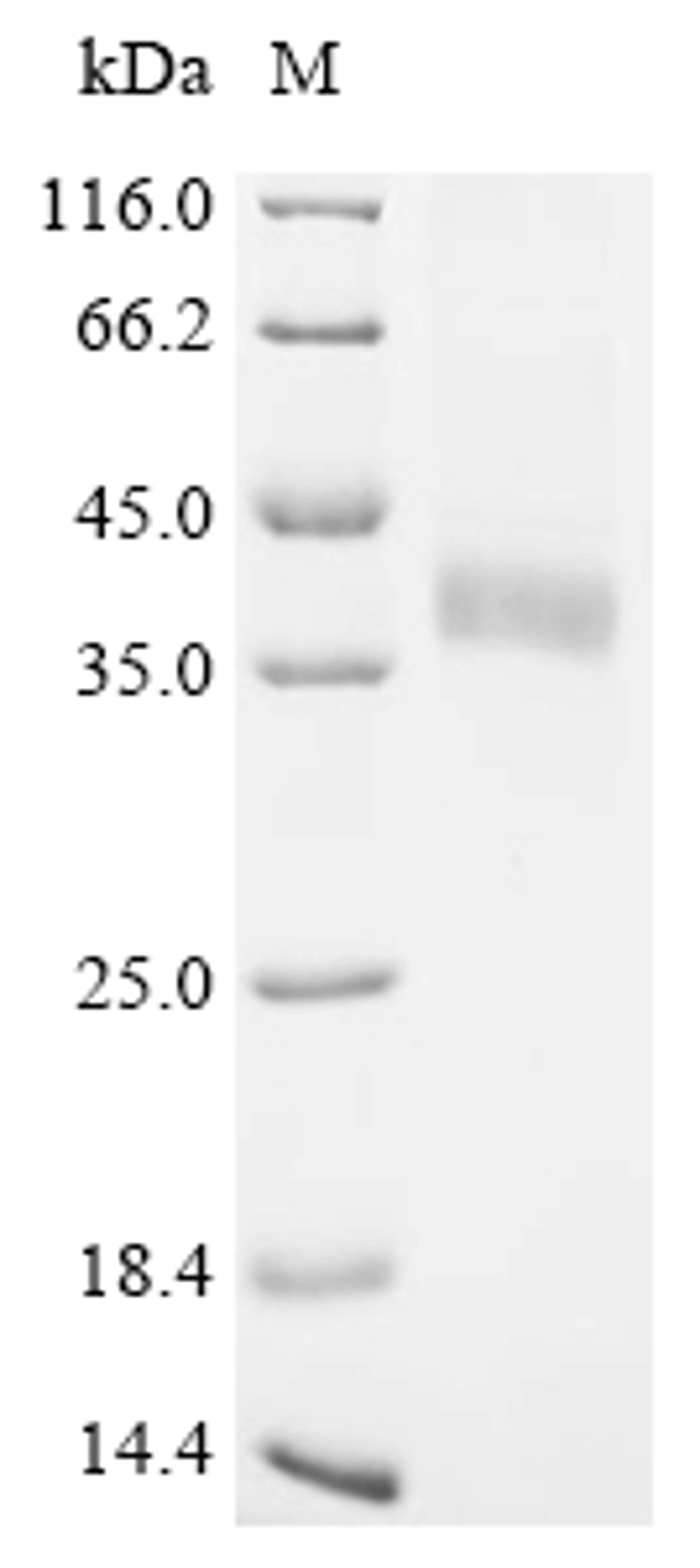 (Tris-Glycine gel) Discontinuous SDS-PAGE (reduced) with 5% enrichment gel and 15% separation gel.