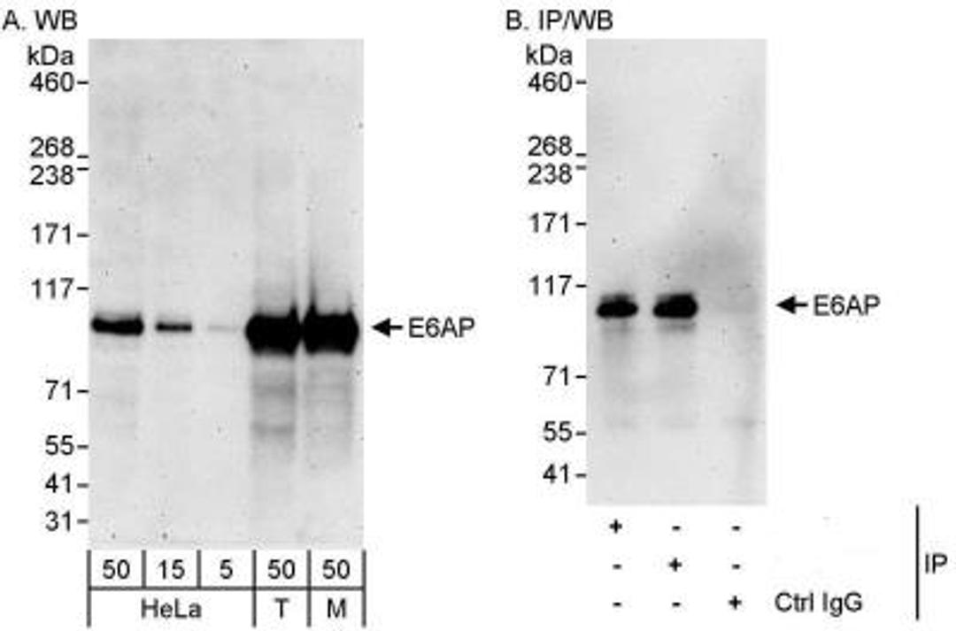 Western Blot: E6AP/UBE3A Antibody [NB500-240] - UBE3A Antibody [NB500-240] -  Samples: Whole cell lysate from HeLa (5, 15 and 50 mcg for WB; 1 mg for IP, 20% of IP loaded), 293T (T; 50 mcg), and mouse NIH3T3 (M; 50 mcg) cells.   Antibodies: Affinity purified rabbit anti-E6AP antibody used for WB at 0.4 mcg/ml (A) and 1 mcg/ml (B) and used for IP at 3 mcg/mg lysate.  E6AP was also immunoprecipitated by rabbit anti-E6AP antibody, which recognizes an upstream epitope.    Detection: Chemiluminescence with exposure times of 3 minutes (A and B).