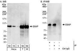 Western Blot: E6AP/UBE3A Antibody [NB500-240] - UBE3A Antibody [NB500-240] -  Samples: Whole cell lysate from HeLa (5, 15 and 50 mcg for WB; 1 mg for IP, 20% of IP loaded), 293T (T; 50 mcg), and mouse NIH3T3 (M; 50 mcg) cells.   Antibodies: Affinity purified rabbit anti-E6AP antibody used for WB at 0.4 mcg/ml (A) and 1 mcg/ml (B) and used for IP at 3 mcg/mg lysate.  E6AP was also immunoprecipitated by rabbit anti-E6AP antibody, which recognizes an upstream epitope.    Detection: Chemiluminescence with exposure times of 3 minutes (A and B).