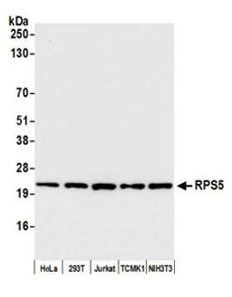 Detection of human and mouse RPS5 by western blot.