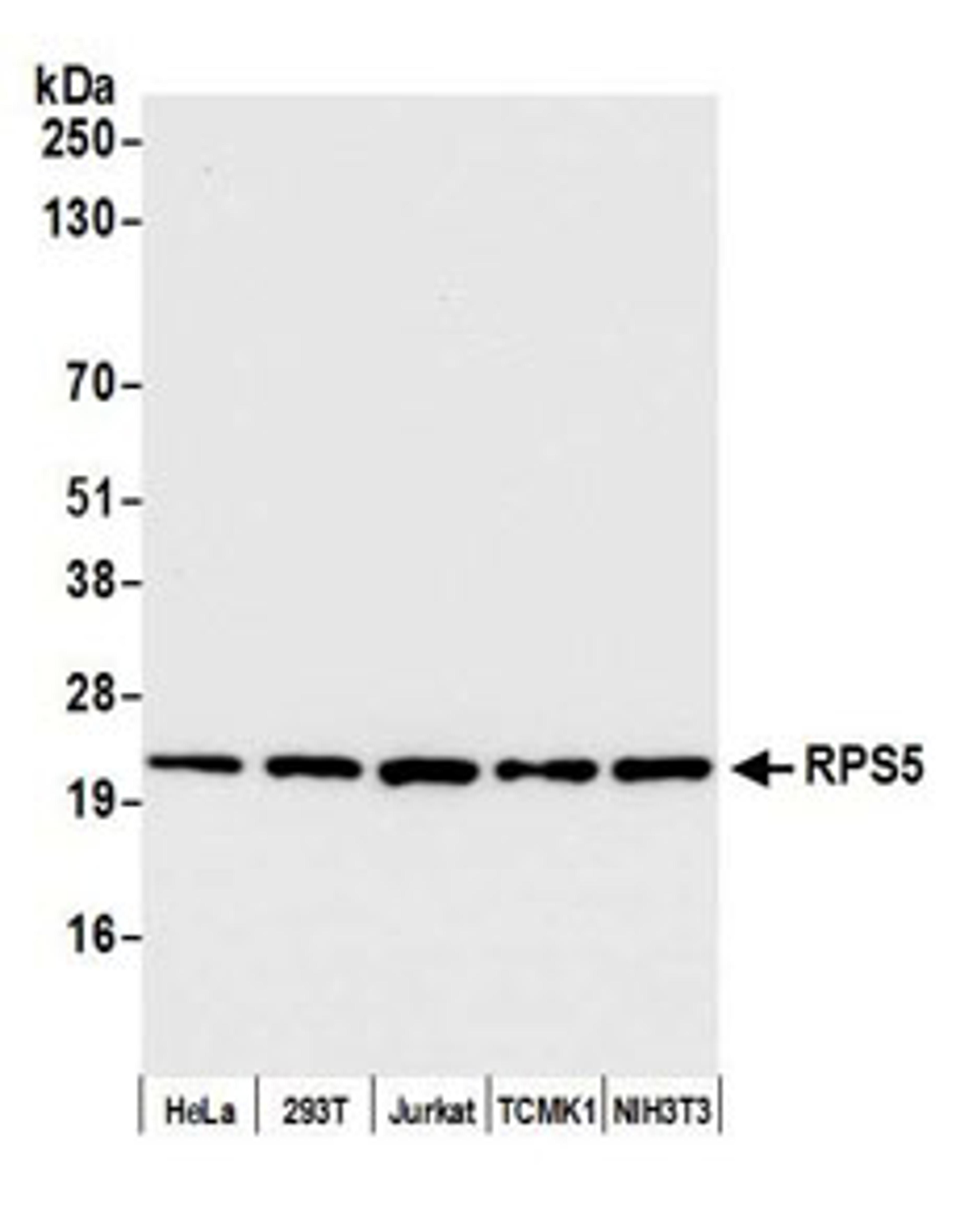 Detection of human and mouse RPS5 by western blot.