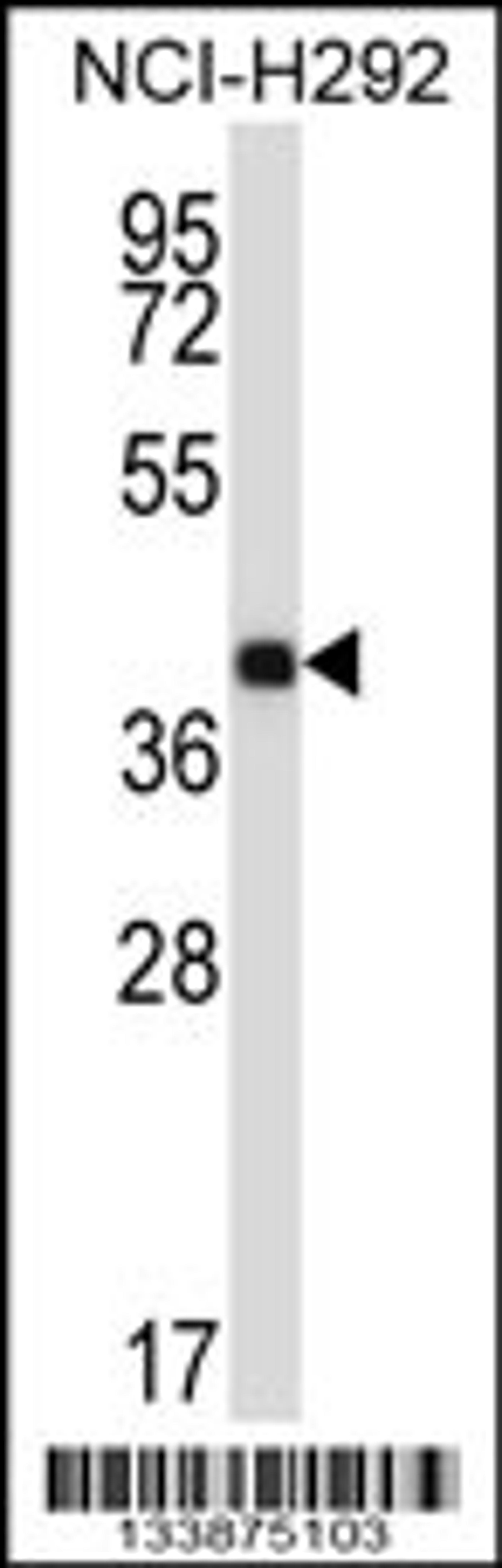 Western blot analysis in NCI-H292 cell line lysates (35ug/lane).