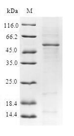(Tris-Glycine gel) Discontinuous SDS-PAGE (reduced) with 5% enrichment gel and 15% separation gel.