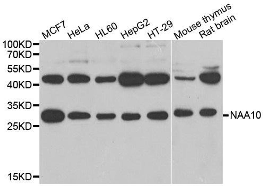 WB analysis of extracts of various cell lines using ARD1A antibody