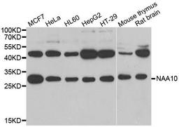 WB analysis of extracts of various cell lines using ARD1A antibody