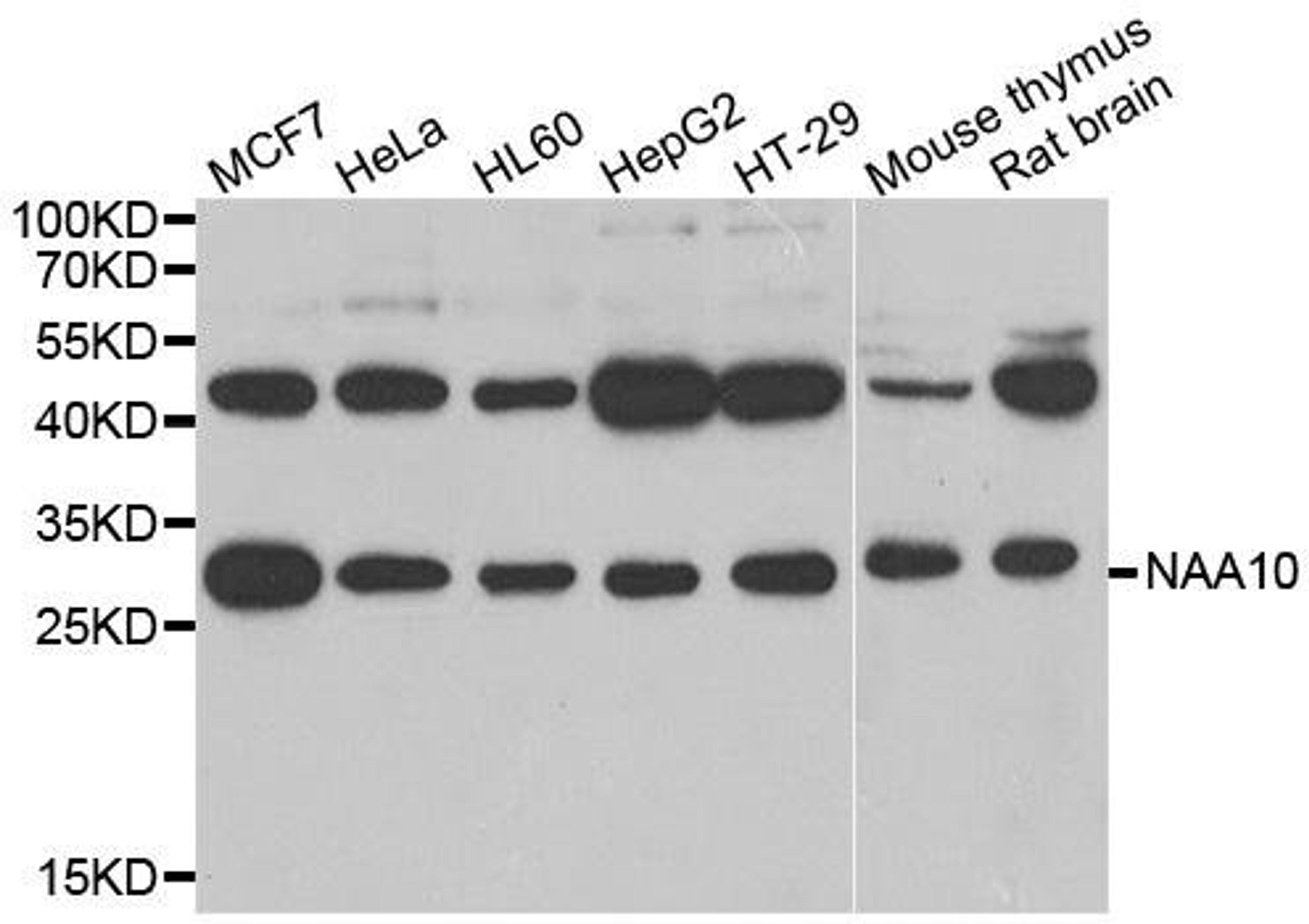 WB analysis of extracts of various cell lines using ARD1A antibody