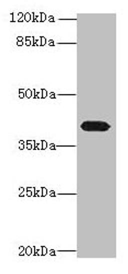 Western blot. All lanes: PTAFR antibody at 4µg/ml + Mouse lung tissue. Secondary. Goat polyclonal to rabbit IgG at 1/10000 dilution. Predicted band size: 40 kDa. Observed band size: 40 kDa