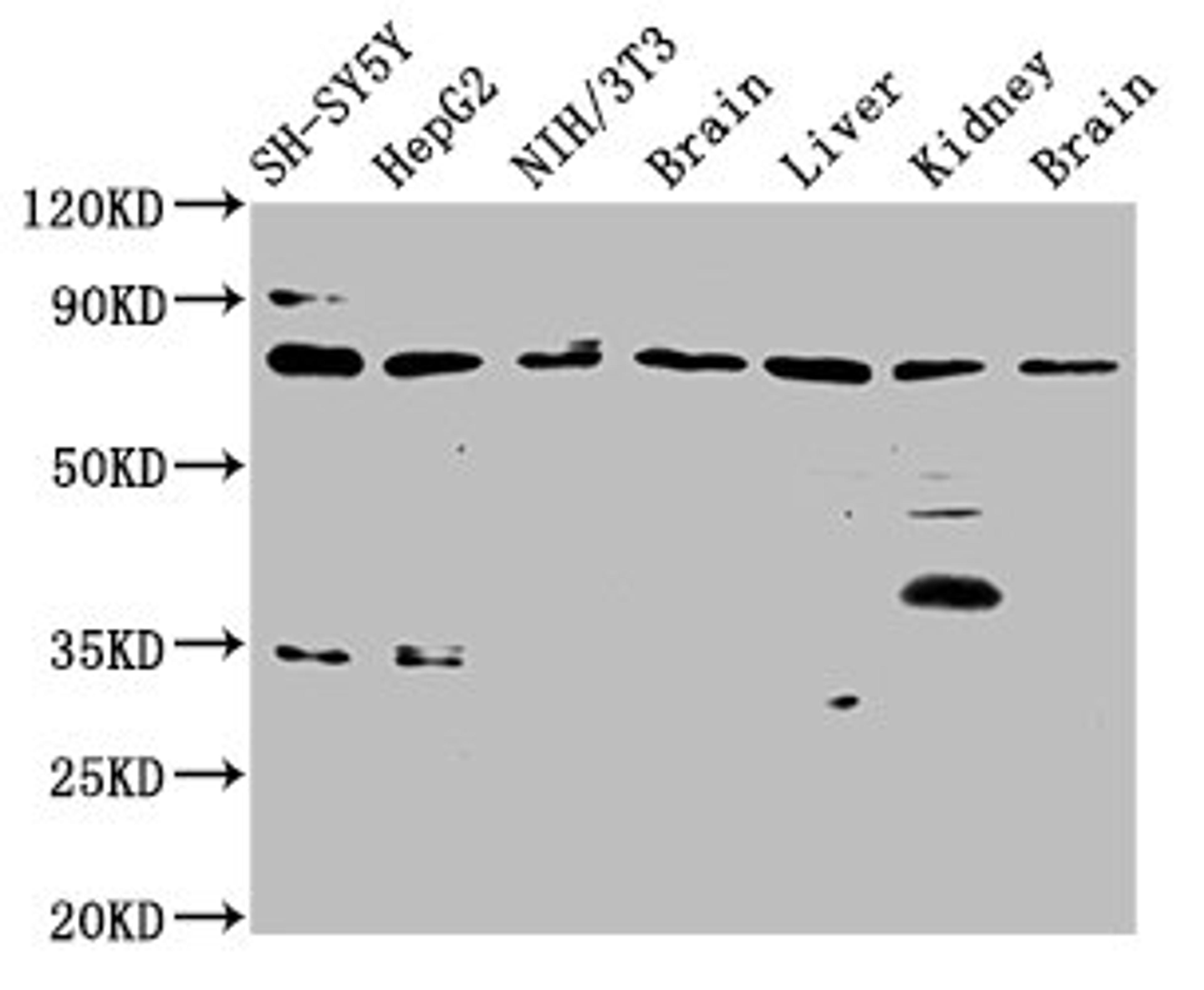 Western Blot. Positive WB detected in: SH-SY5Y whole cell lysate, HepG2 whole cell lysate, NIH/3T3 whole cell lysate, Rat brain tissue, Rat liver tissue, Rat kidney tissue, Mouse brain tissue. All lanes: CUX1 antibody at 3.7µg/ml. Secondary. Goat polyclonal to rabbit IgG at 1/50000 dilution. Predicted band size: 78, 73, 165, 162, 166, 154, 158, 148, 76 kDa. Observed band size: 78 kDa