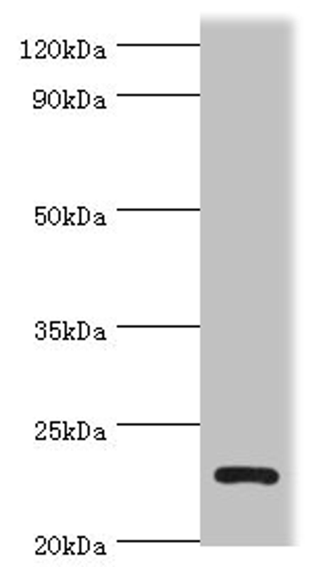 Western blot. All lanes: APOBEC3C antibody at 3ug/ml + K562 whole cell lysate. Secondary. Goat polyclonal to rabbit IgG at 1/10000 dilution. Predicted band size: 23 kDa. Observed band size: 23 kDa.