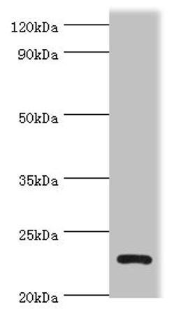 Western blot. All lanes: APOBEC3C antibody at 3ug/ml + K562 whole cell lysate. Secondary. Goat polyclonal to rabbit IgG at 1/10000 dilution. Predicted band size: 23 kDa. Observed band size: 23 kDa.