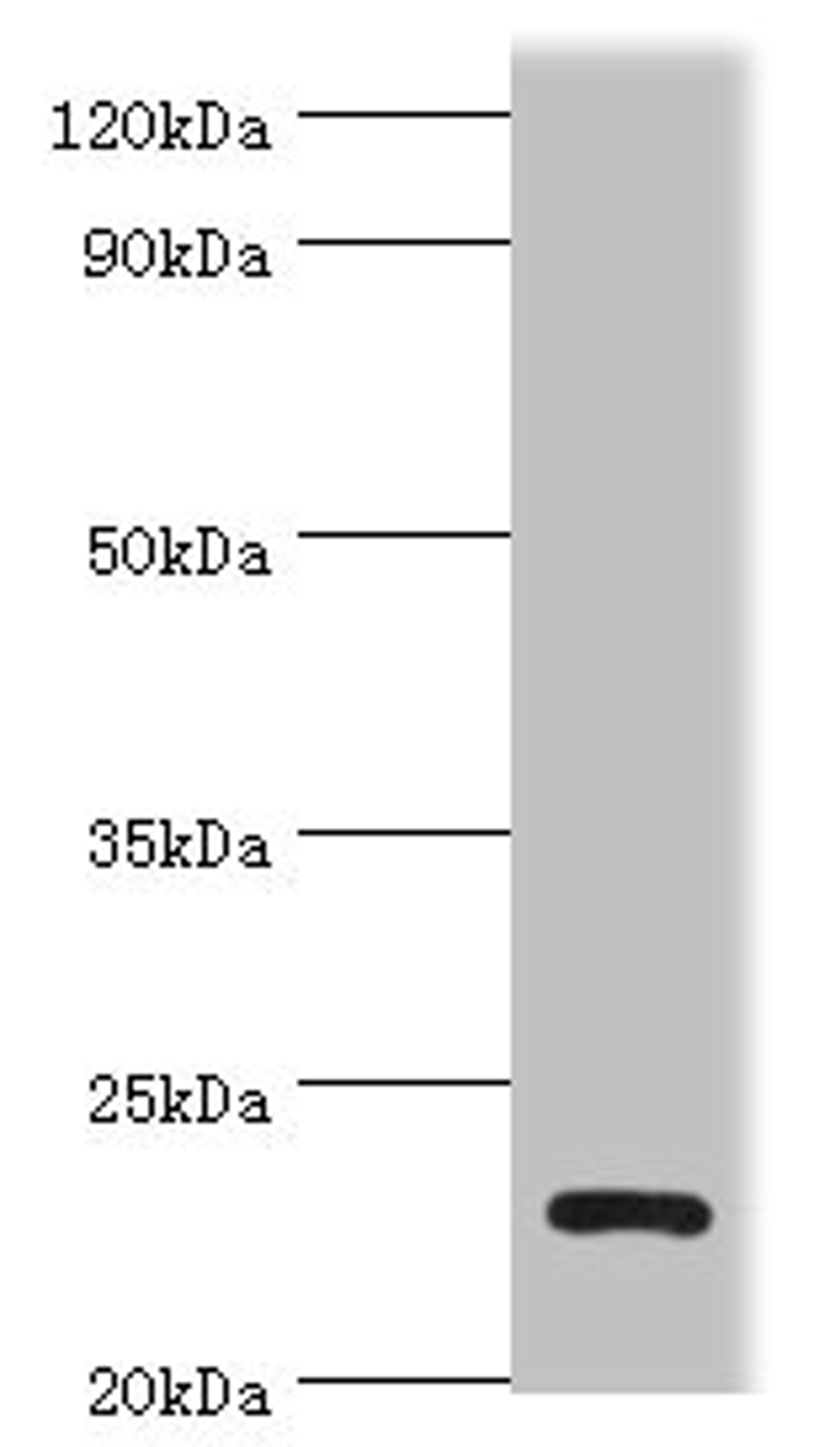 Western blot. All lanes: APOBEC3C antibody at 3ug/ml + K562 whole cell lysate. Secondary. Goat polyclonal to rabbit IgG at 1/10000 dilution. Predicted band size: 23 kDa. Observed band size: 23 kDa.