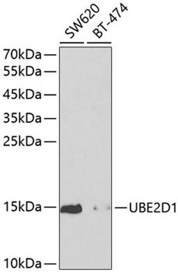 Western blot - UBE2D1 antibody (A1951)