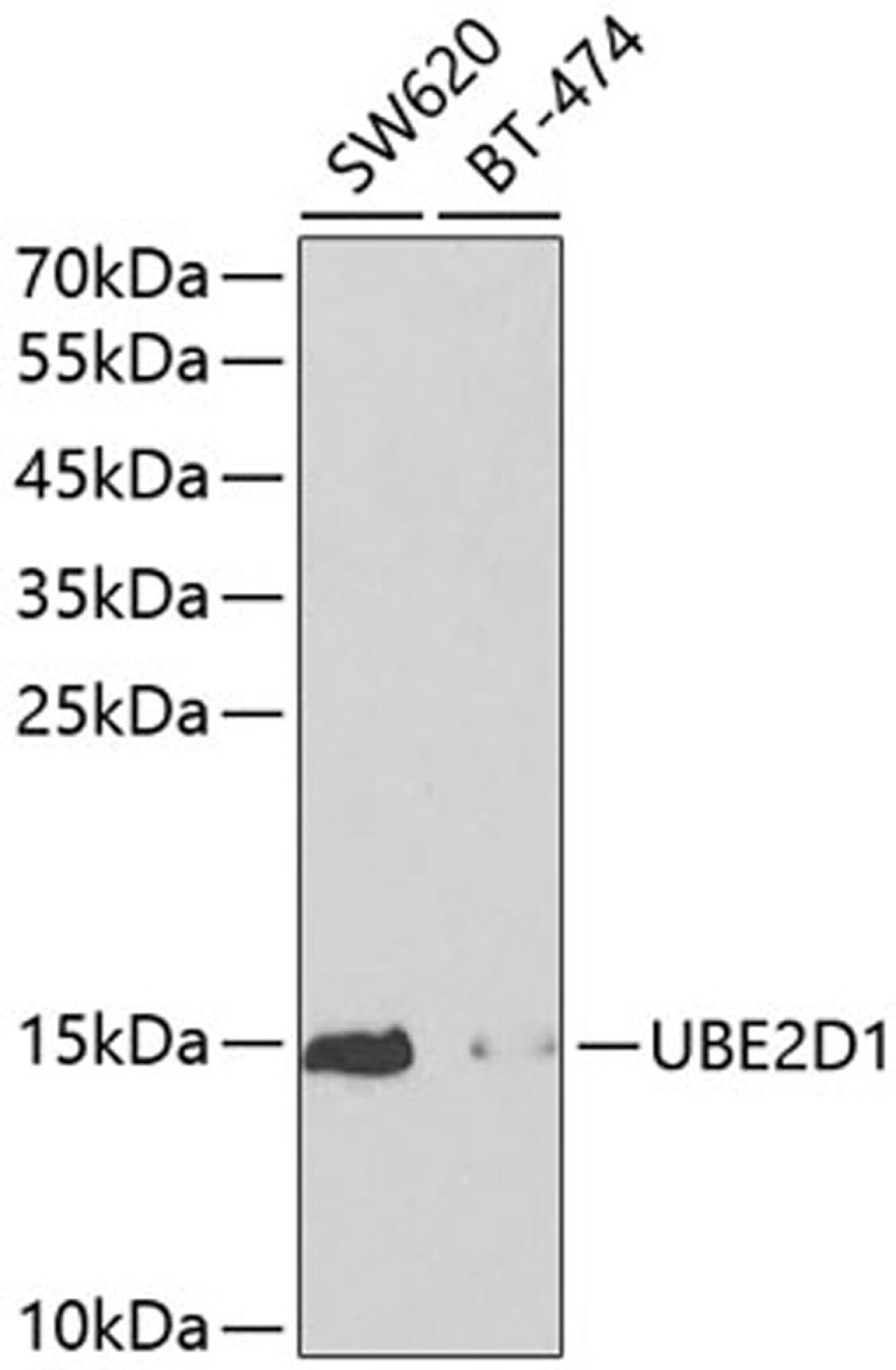 Western blot - UBE2D1 antibody (A1951)