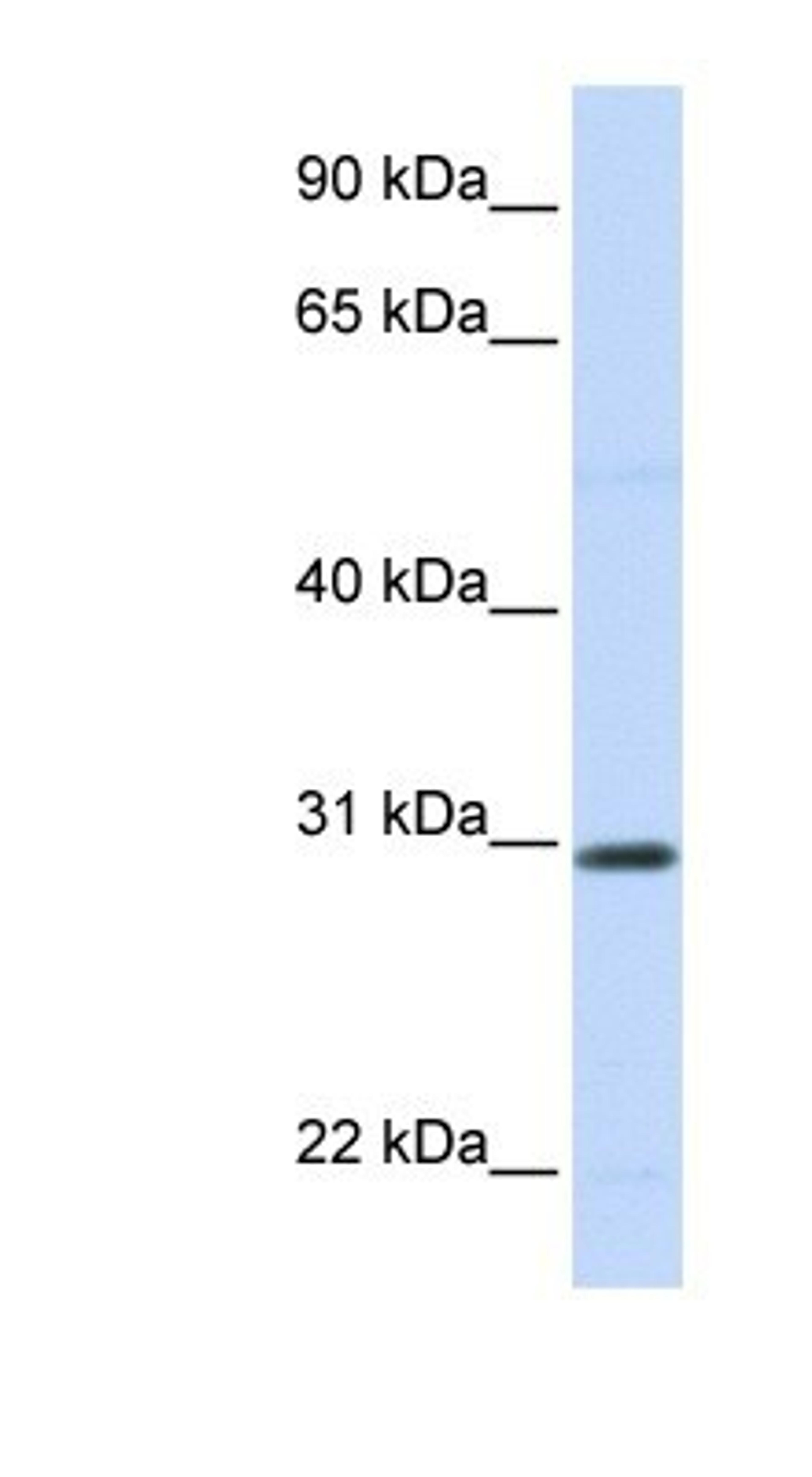 Western Blot: Stanniocalcin 1/STC-1 Antibody [NBP1-59310] - Titration: 0.2-1 ug/ml, Positive Control: 721_B cell lysate.