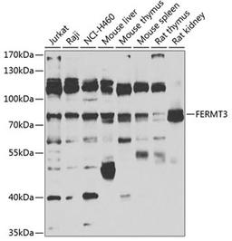 Western blot - FERMT3 antibody (A7839)