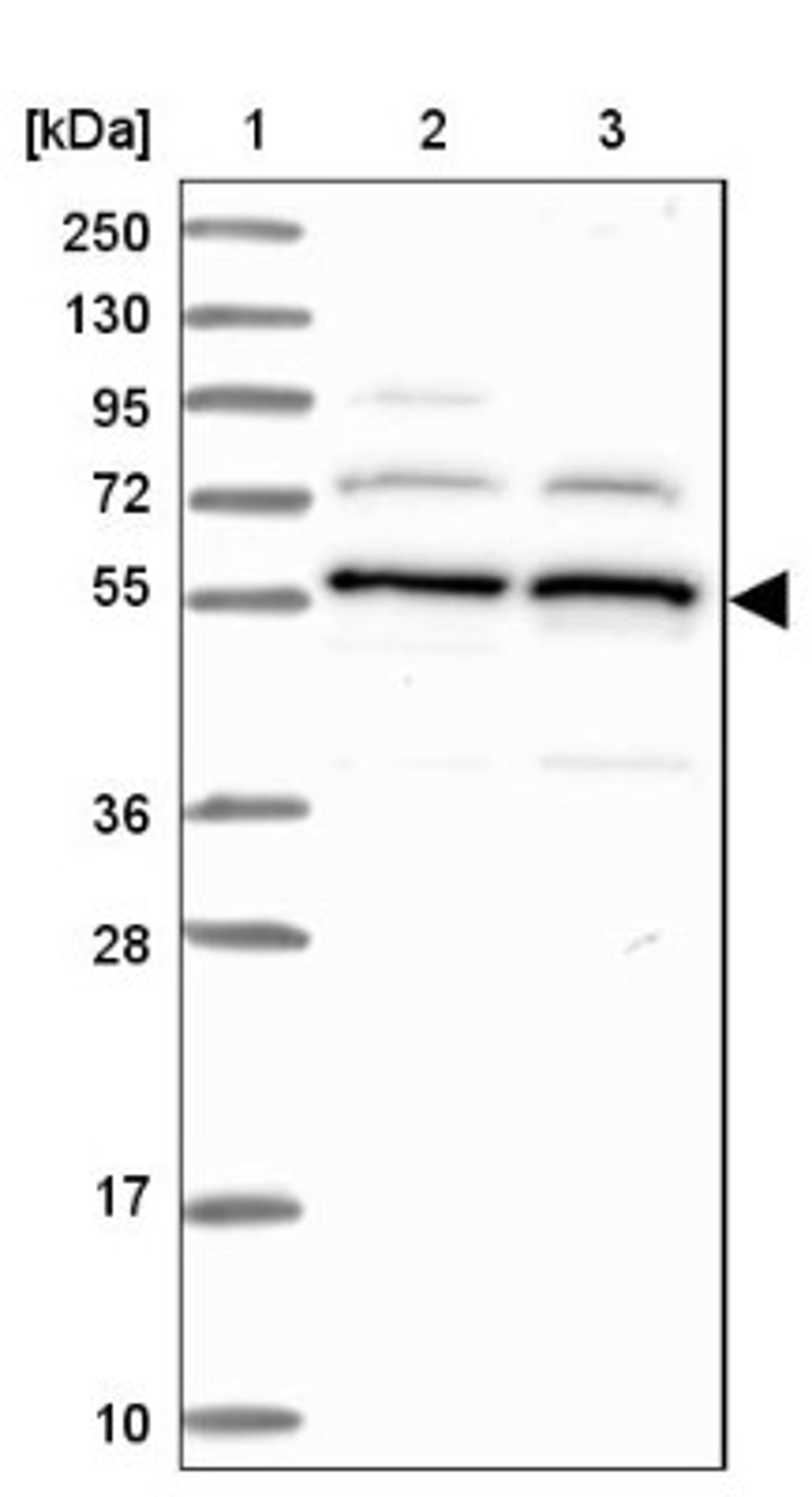 Western Blot: C5orf22 Antibody [NBP1-83769] - Lane 1: Marker [kDa] 250, 130, 95, 72, 55, 36, 28, 17, 10<br/>Lane 2: Human cell line RT-4<br/>Lane 3: Human cell line U-251MG sp