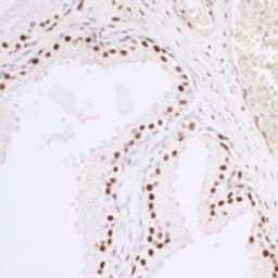 Detection of human Caper by immunohistochemistry.