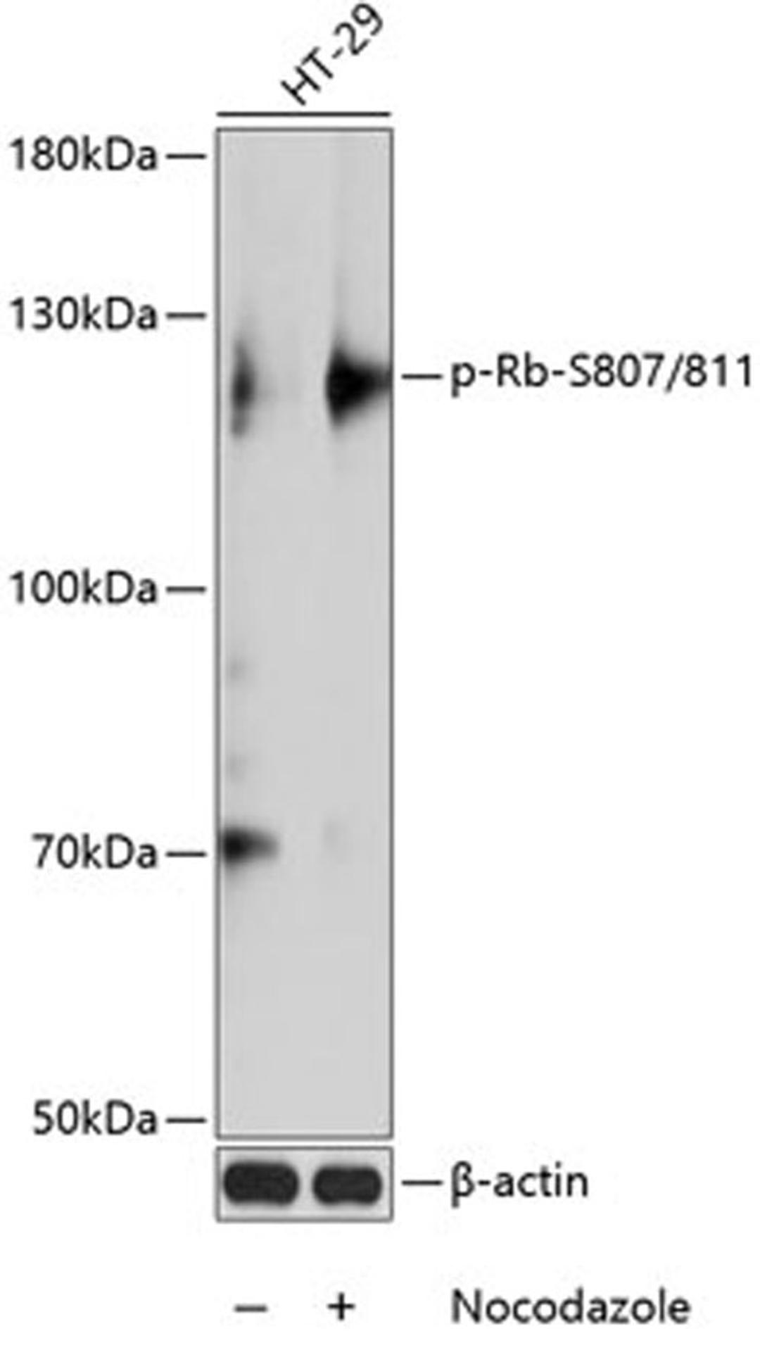 Western blot - Phospho-Rb-S807/811 antibody (AP0484)