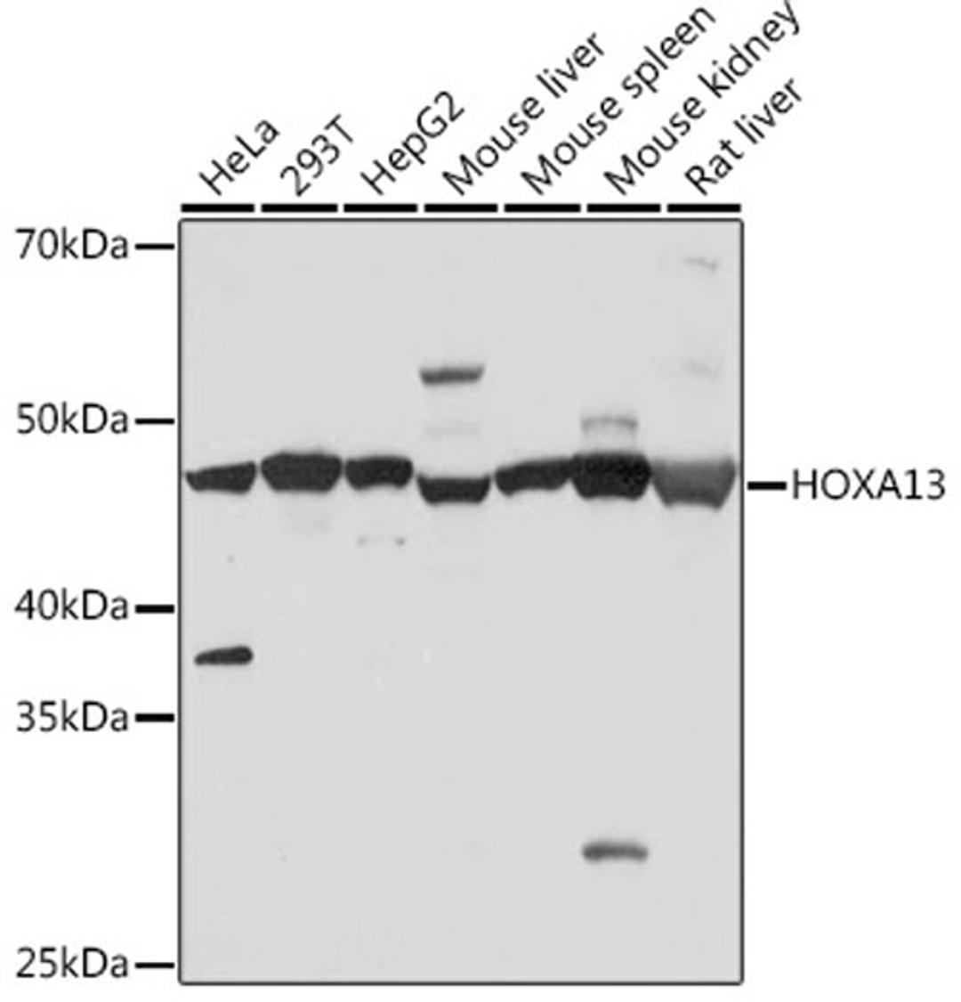 Western blot - HOXA13 Rabbit mAb (A9564)