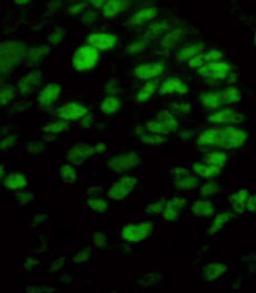 Detection of human p53 by immunofluorescence.