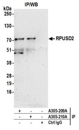 Detection of human RPUSD2 by western blot of immunoprecipitates.