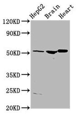 Western Blot. Positive WB detected in: HepG2 whole cell lysate, Rat brain tissue, Rat heart tissue. All lanes: AGT antibody at 4µg/ml. Secondary. Goat polyclonal to rabbit IgG at 1/50000 dilution. Predicted band size: 54 kDa. Observed band size: 54 kDa