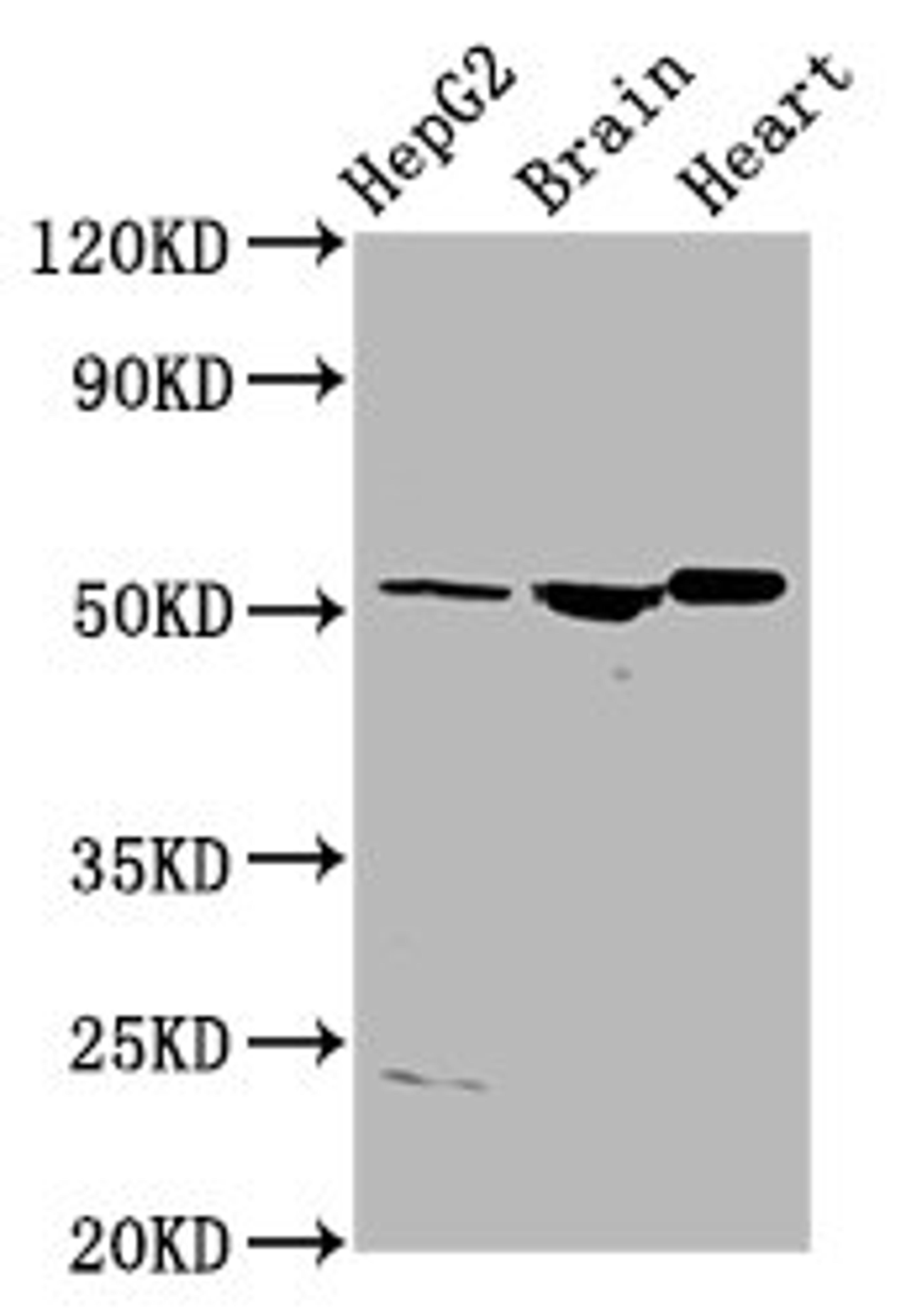 Western Blot. Positive WB detected in: HepG2 whole cell lysate, Rat brain tissue, Rat heart tissue. All lanes: AGT antibody at 4µg/ml. Secondary. Goat polyclonal to rabbit IgG at 1/50000 dilution. Predicted band size: 54 kDa. Observed band size: 54 kDa