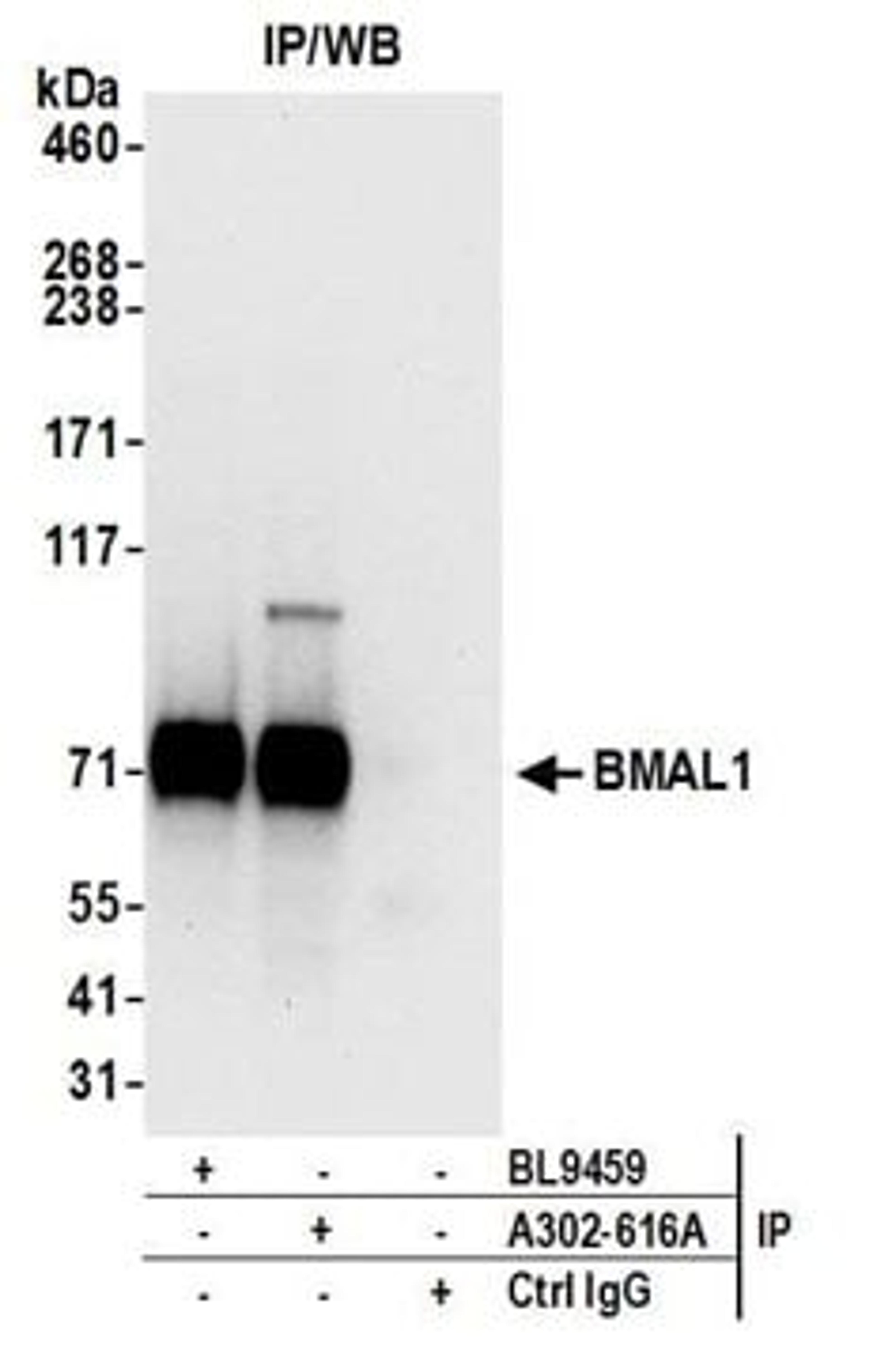 Detection of human BMAL1 by western blot of immunoprecipitates.