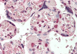 Immunohistochemical staining of Human Placenta using CREB3L2 antibody