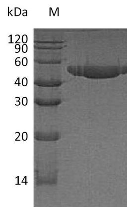 (Tris-Glycine gel) Discontinuous SDS-PAGE (reduced) with 5% enrichment gel and 15% separation gel.