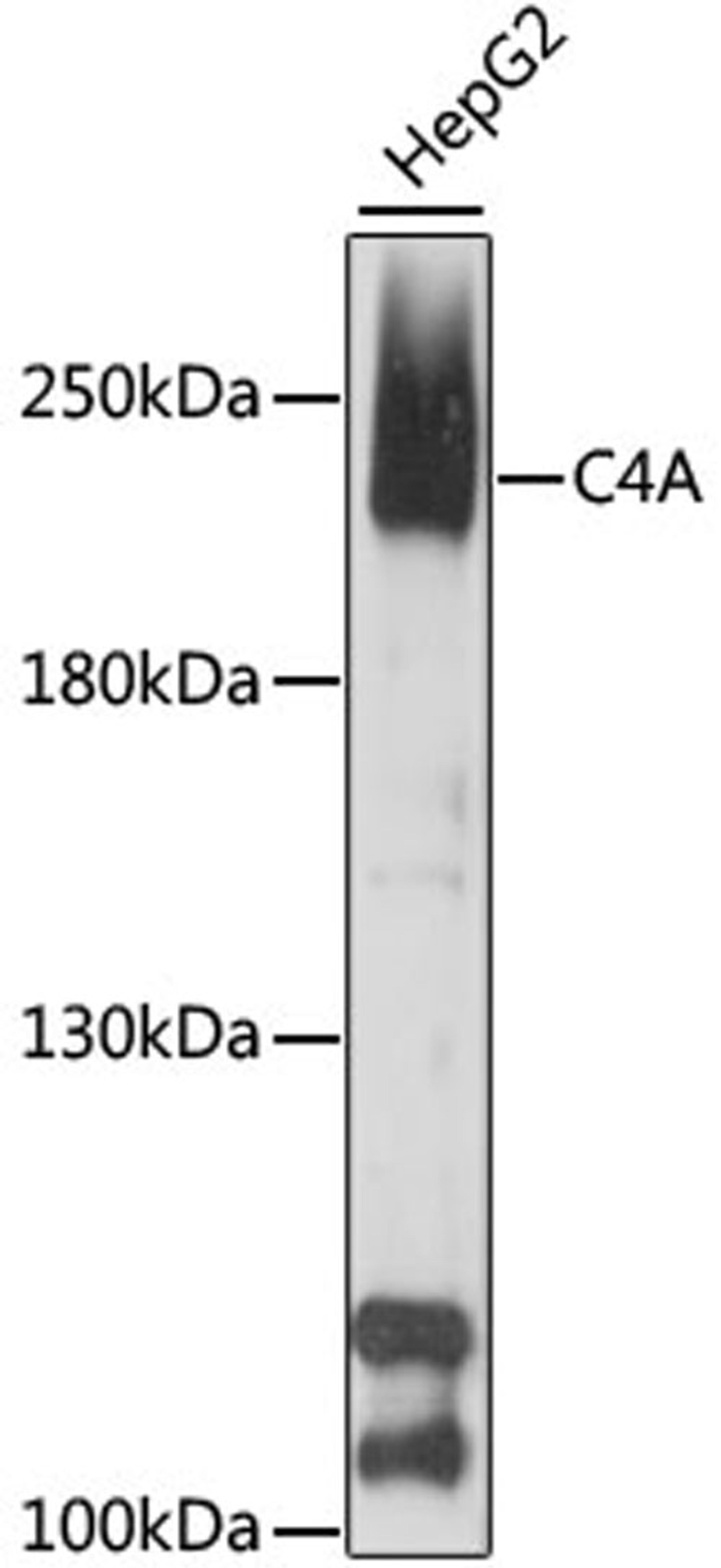 Western blot - C4A antibody (A9511)