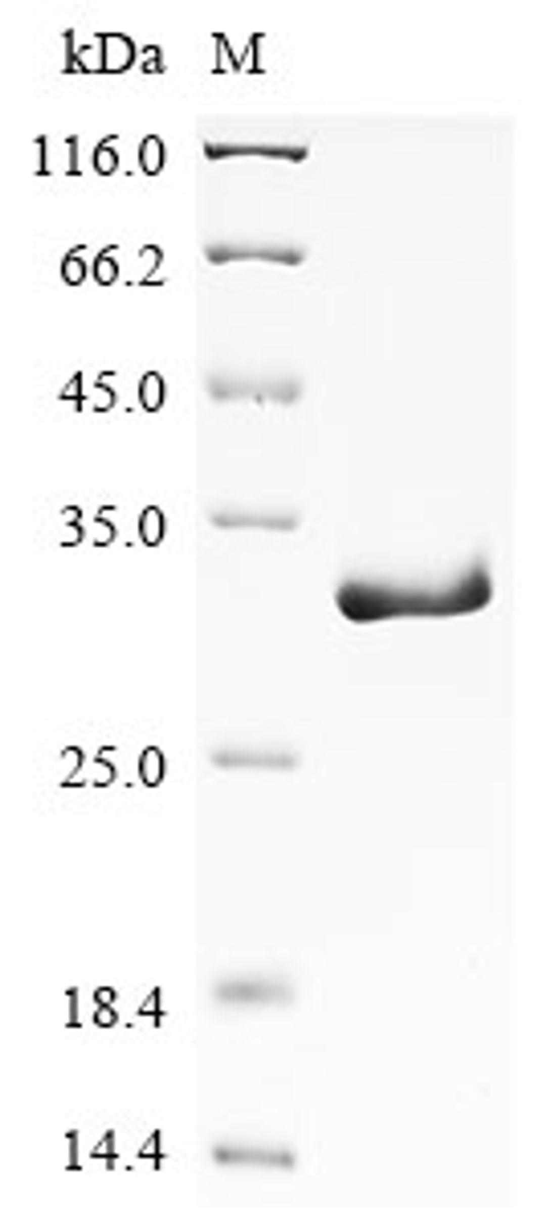 (Tris-Glycine gel) Discontinuous SDS-PAGE (reduced) with 5% enrichment gel and 15% separation gel.