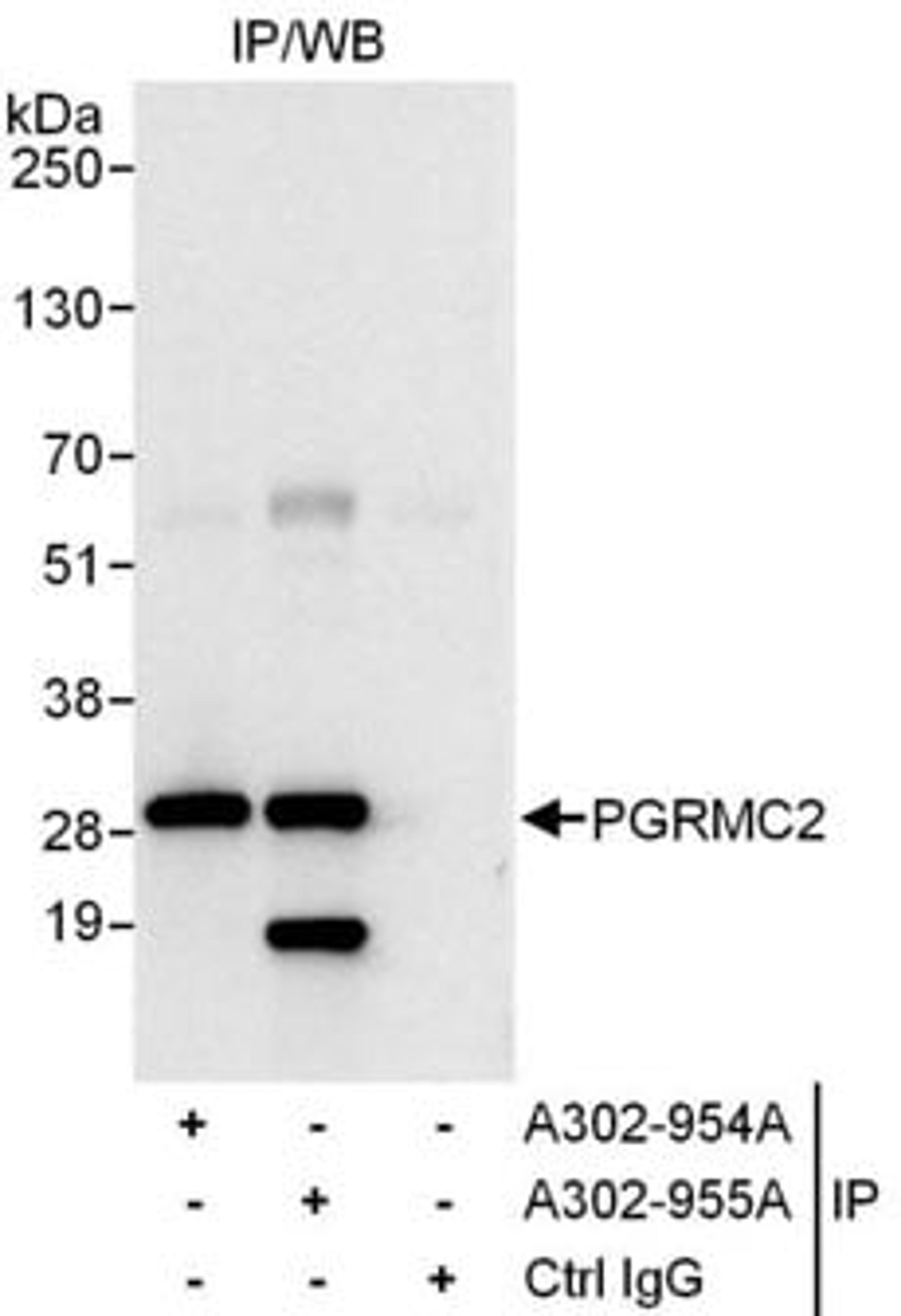 Detection of human PGRMC2 by western blot of immunoprecipitates.