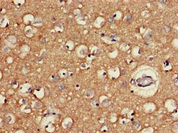 Immunohistochemistry of paraffin-embedded human brain tissue using CSB-PA819472LA01HU at dilution of 1:100