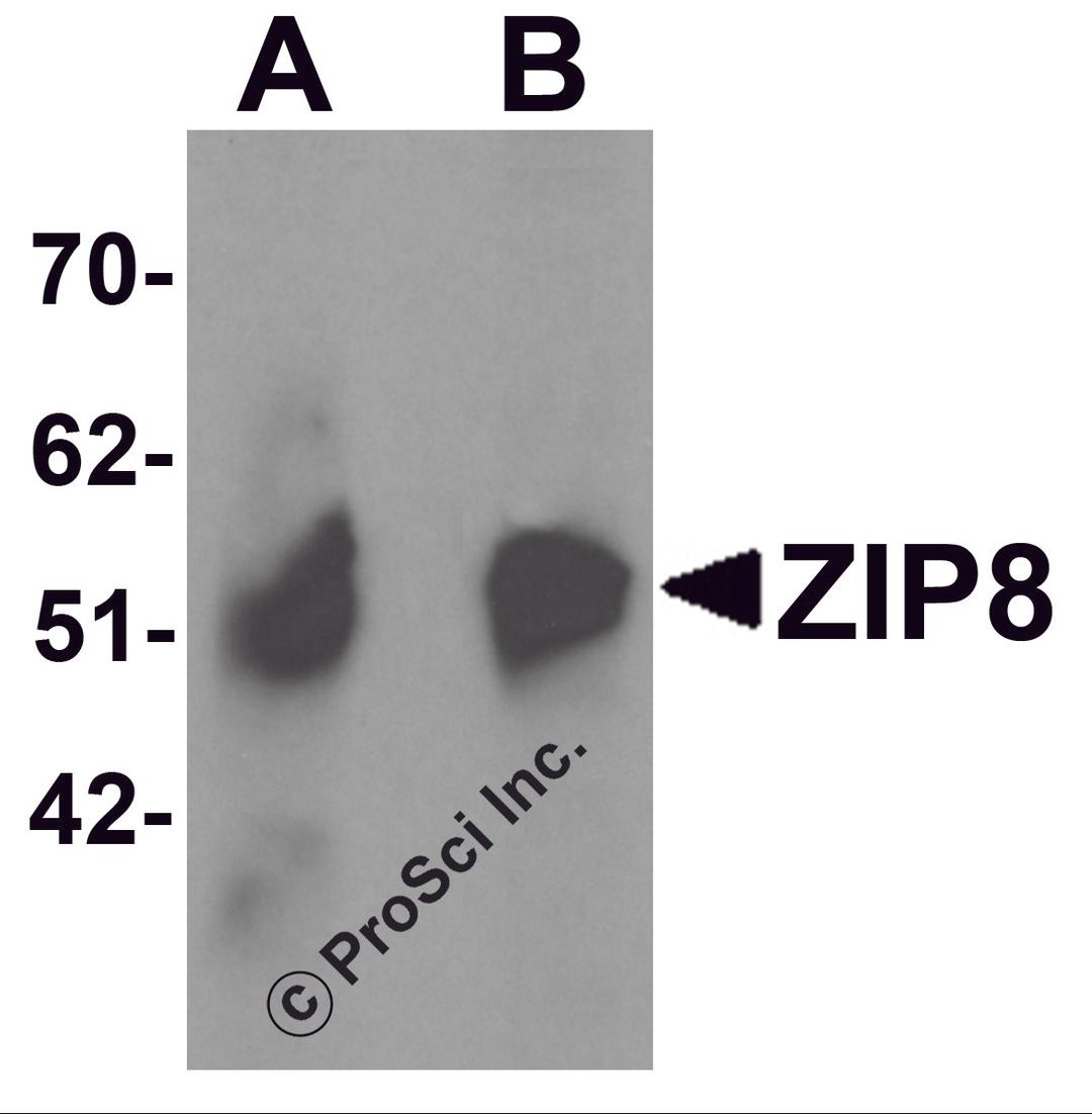 Western blot analysis of ZIP8 in human spleen tissue lysate with ZIP8 antibody at (A) 1 and (B) 2 μg/mL.