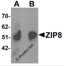 Western blot analysis of ZIP8 in human spleen tissue lysate with ZIP8 antibody at (A) 1 and (B) 2 μg/mL.