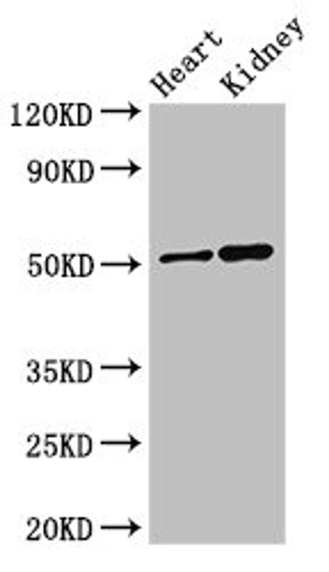 Western Blot. Positive WB detected in: Mouse heart tissue, Mouse kidney tissue. All lanes: SIGLEC7 antibody at 3ug/ml. Secondary. Goat polyclonal to rabbit IgG at 1/50000 dilution. Predicted band size: 52, 42, 17 kDa. Observed band size: 52 kDa. 
