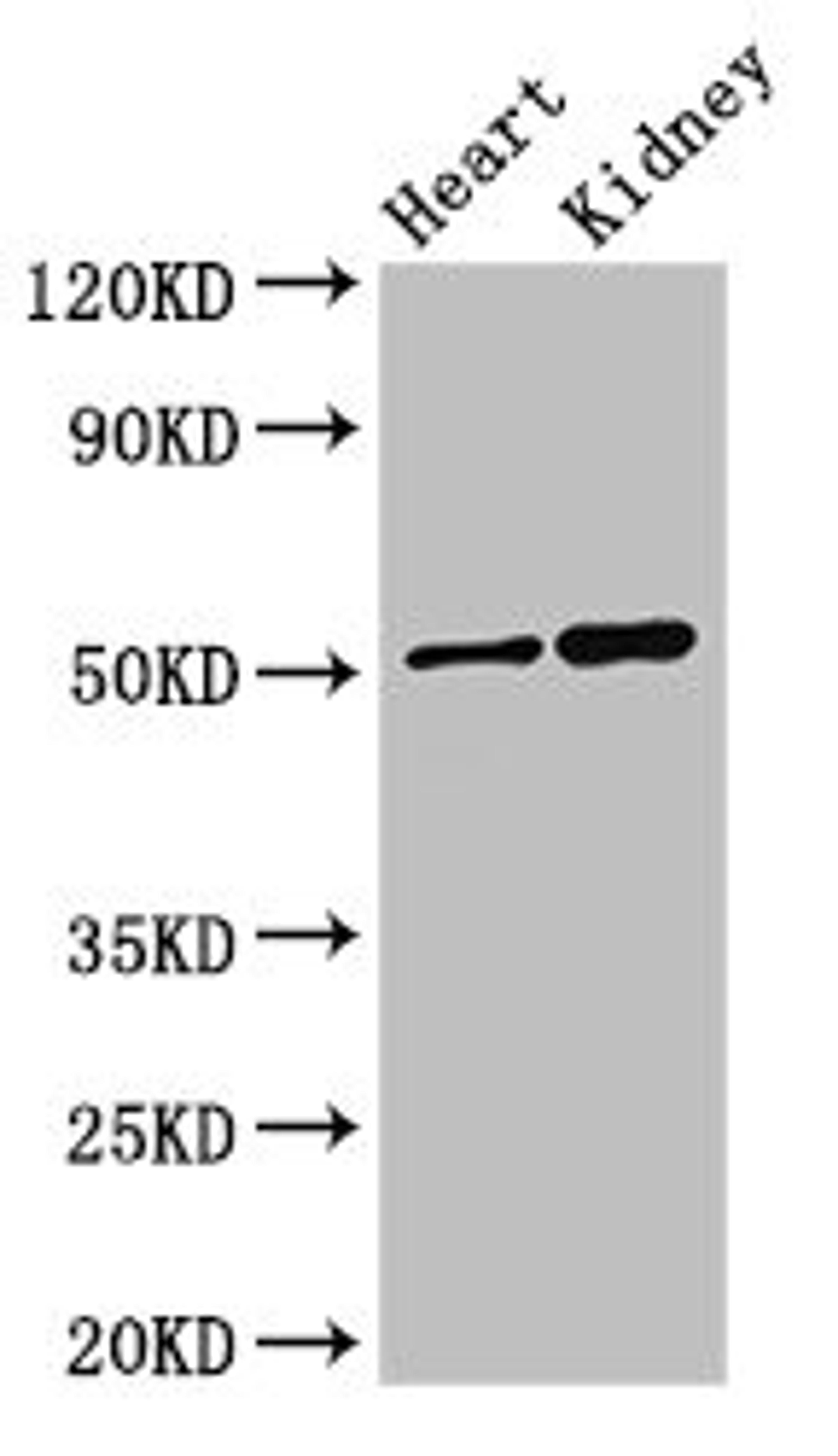 Western Blot. Positive WB detected in: Mouse heart tissue, Mouse kidney tissue. All lanes: SIGLEC7 antibody at 3ug/ml. Secondary. Goat polyclonal to rabbit IgG at 1/50000 dilution. Predicted band size: 52, 42, 17 kDa. Observed band size: 52 kDa. 