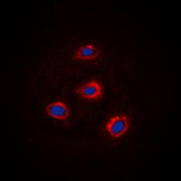 Immunofluorescense analysis of HEK293 cells using Alpha-adducin antibody