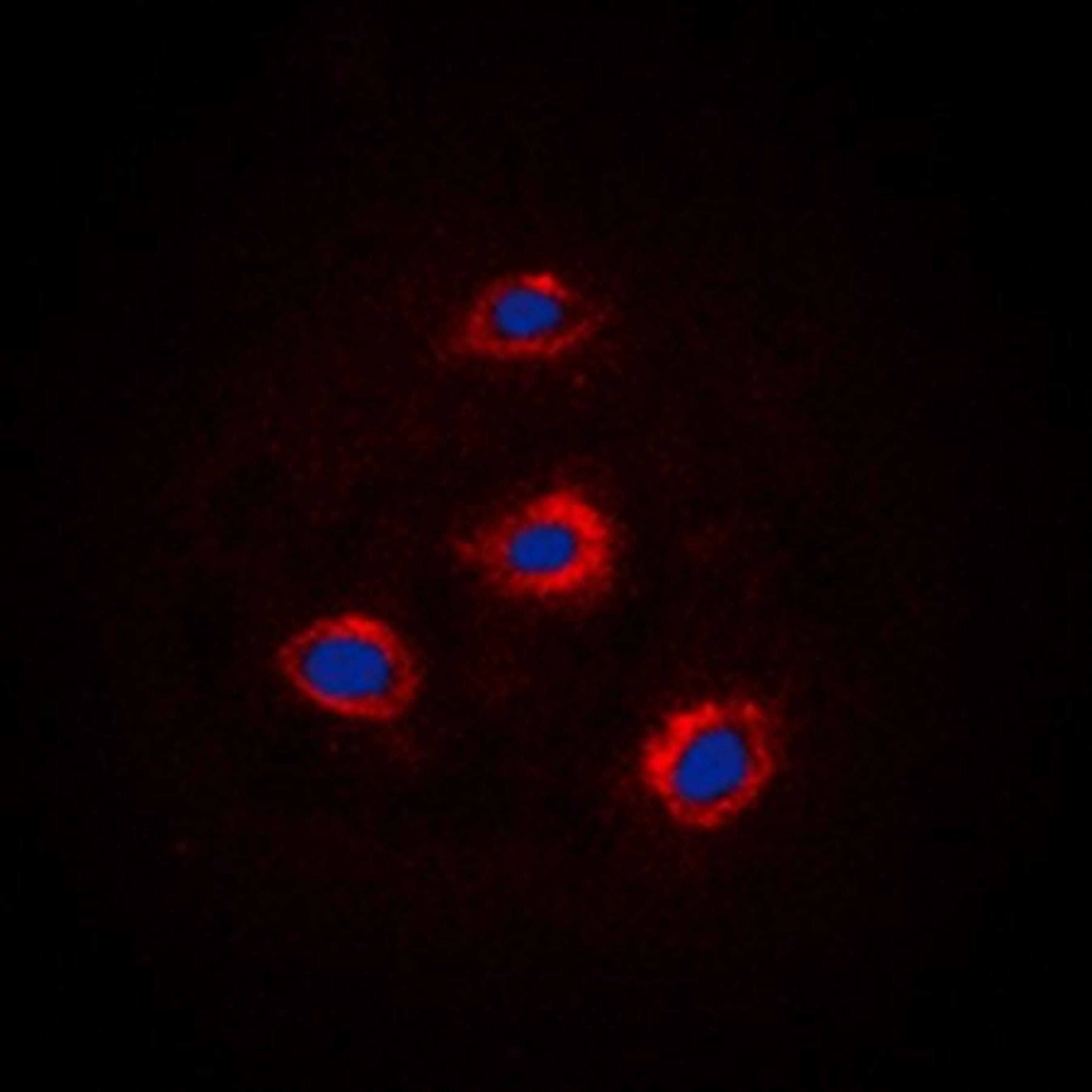 Immunofluorescense analysis of HEK293 cells using Alpha-adducin antibody