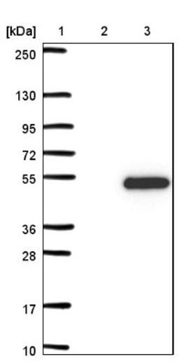 Western Blot: TBC1D20 Antibody [NBP1-92478] - Lane 1: Marker [kDa] 250, 130, 95, 72, 55, 36, 28, 17, 10<br/>Lane 2: Negative control (vector only transfected HEK293T lysate)<br/>Lane 3: Over-expression lysate (Co-expressed with a C-terminal myc-DDK tag (~3.1 kDa) in mammalian HEK293T cells, LY408259)