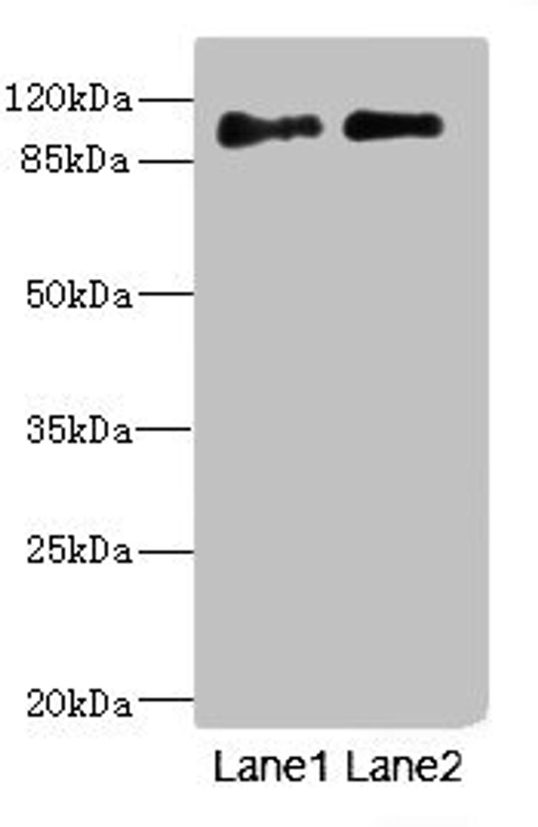 Western blot. All lanes: ICAM5 antibody at 4.2ug/ml. Lane 1: HepG2 whole cell lysate. Lane 2: A549 whole cell lysate. Secondary. Goat polyclonal to rabbit IgG at 1/10000 dilution. Predicted band size: 97 kDa. Observed band size: 97 kDa. 