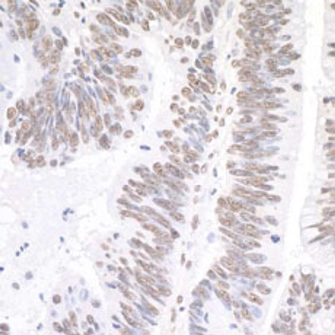 Detection of human XRN2 by immunohistochemistry.