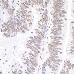 Detection of human XRN2 by immunohistochemistry.