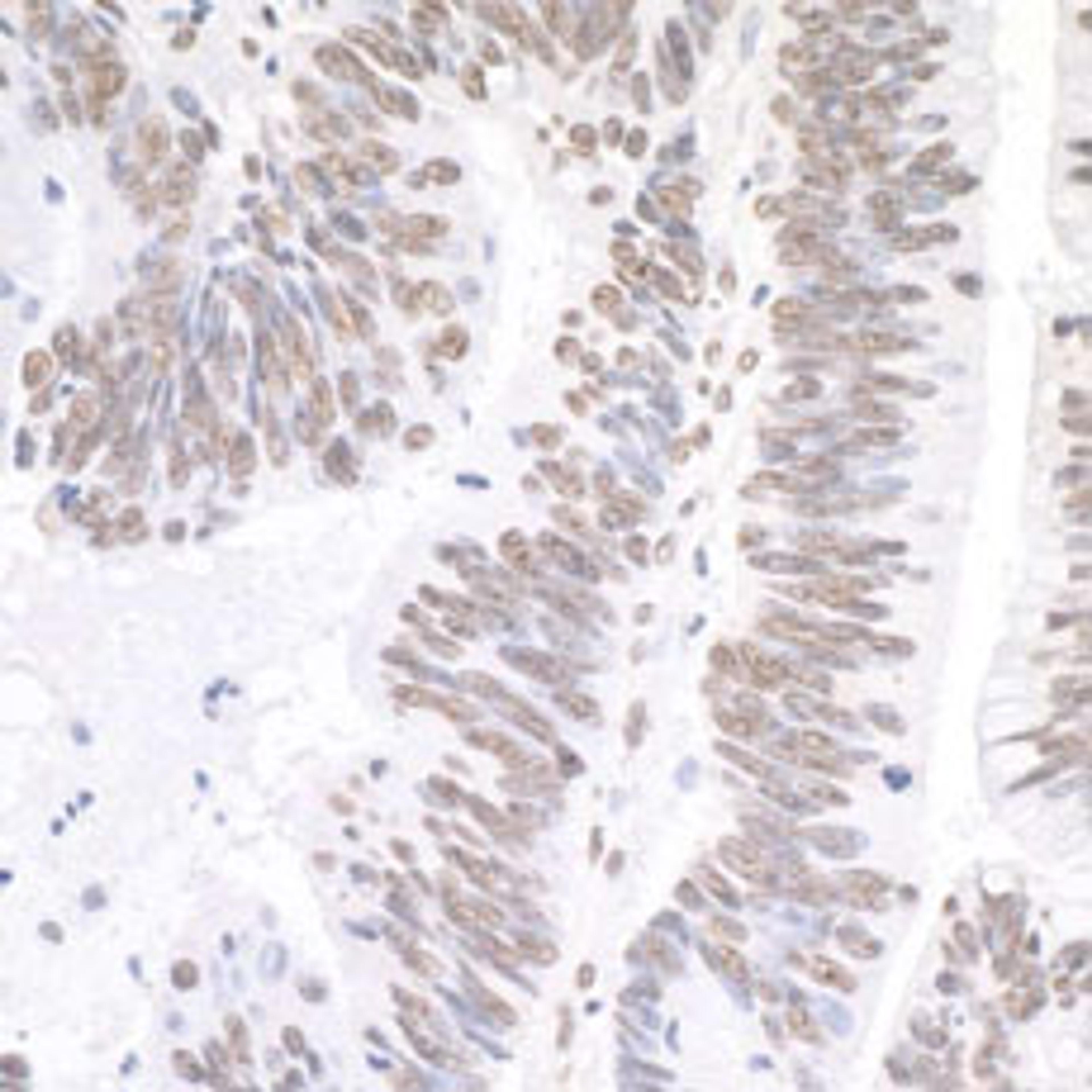 Detection of human XRN2 by immunohistochemistry.