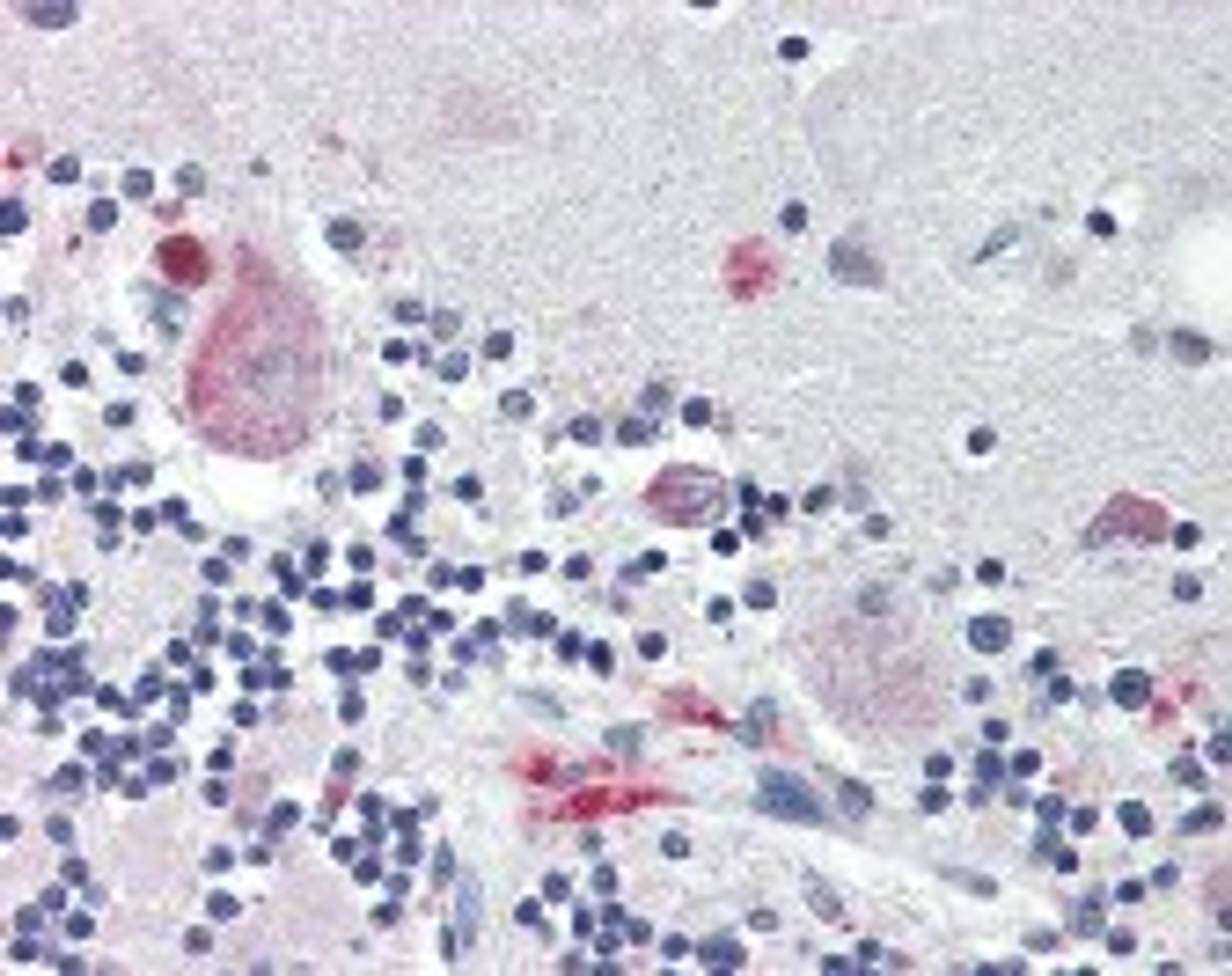 Immunohistochemistry staining of Noggin in cerebellum tissue using Noggin Antibody.