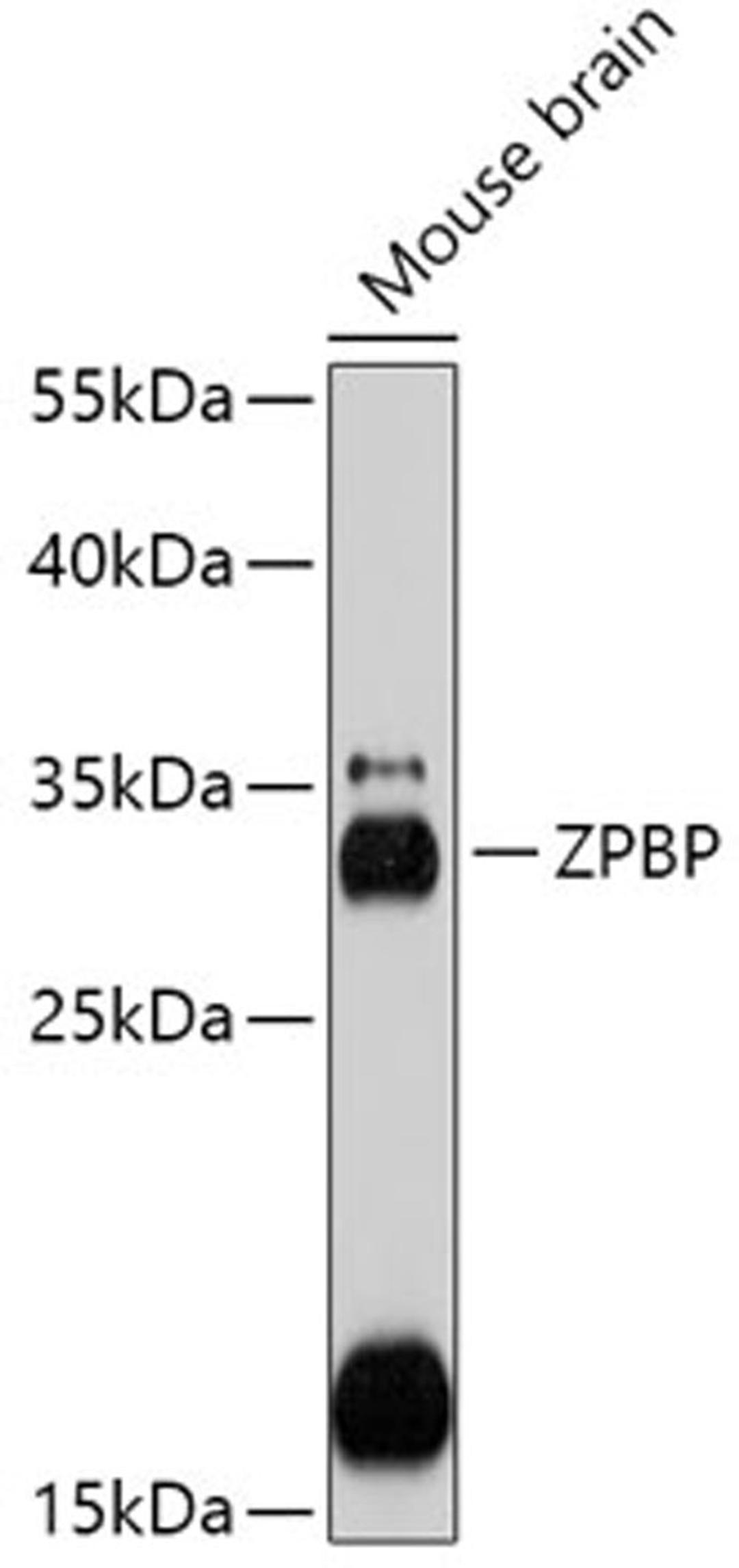 Western blot - ZPBP antibody (A17625)