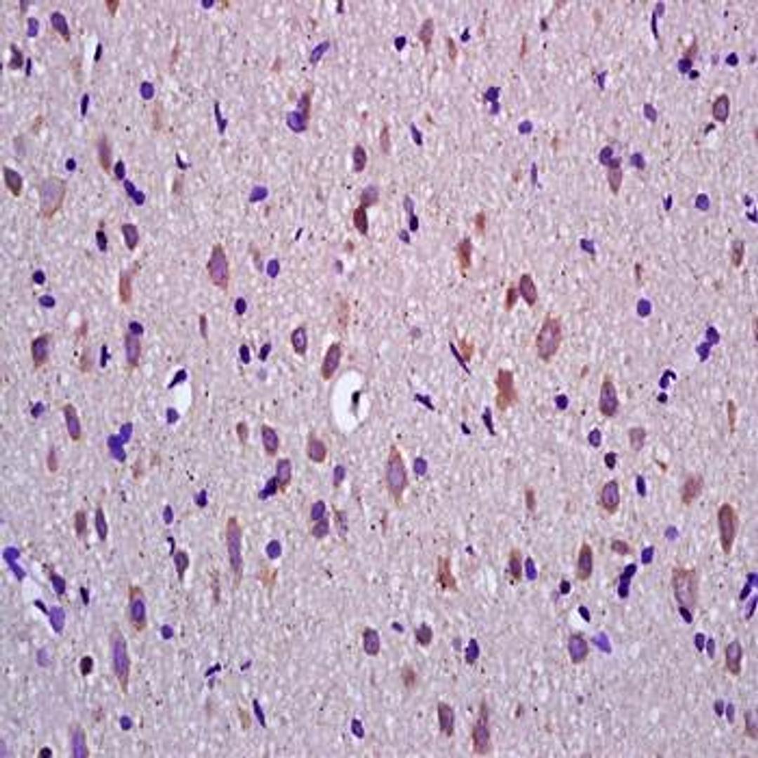 Immunohistochemical analysis of formalin-fixed and paraffin embedded rat brain tissue (dilution at:1:200) using Apolipoprotein D antibody