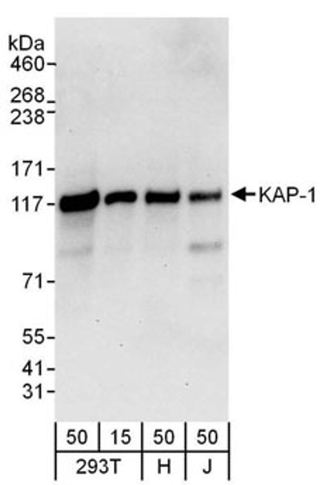 Detection of human KAP-1 by western blot.