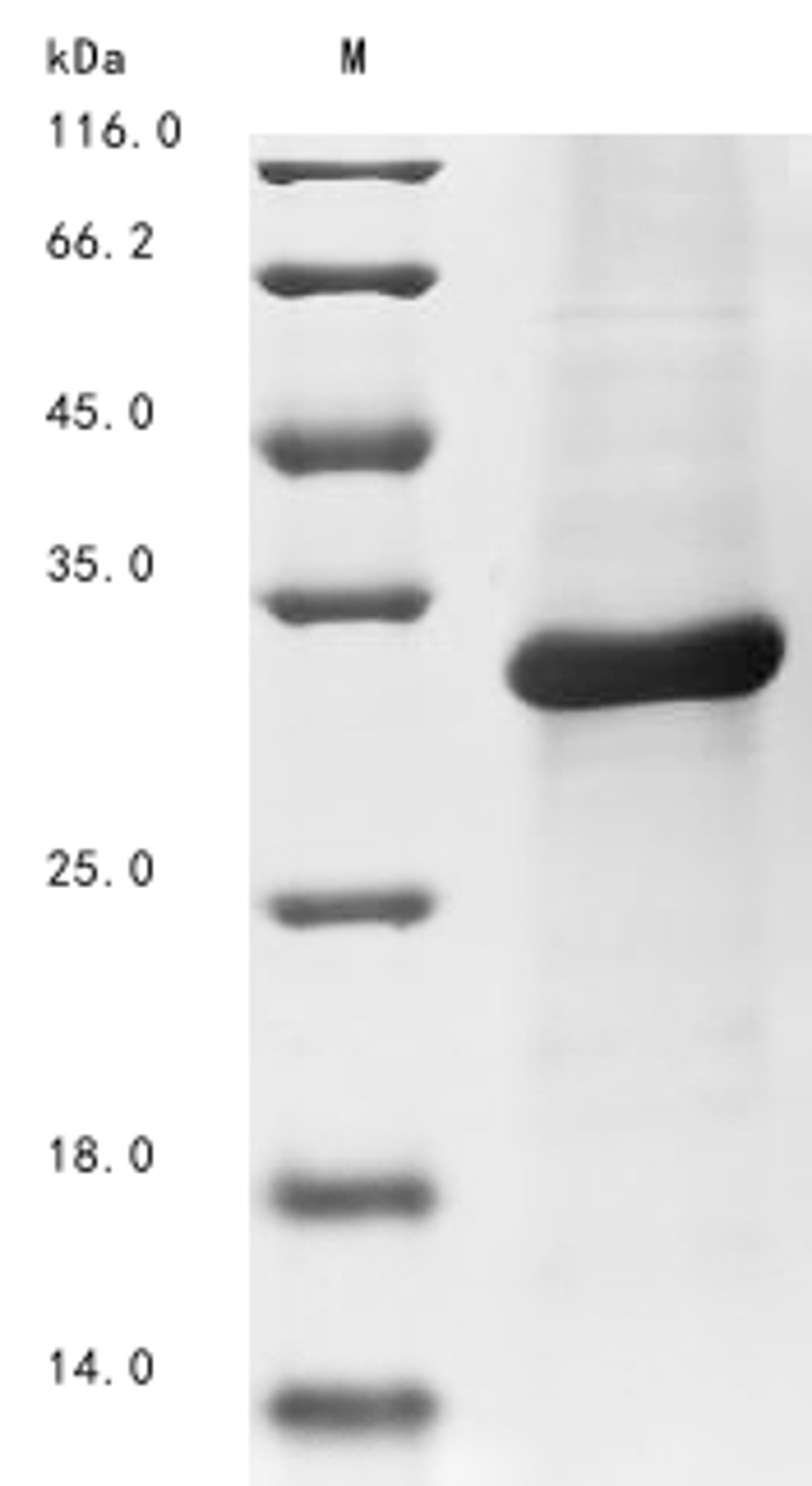 (Tris-Glycine gel) Discontinuous SDS-PAGE (reduced) with 5% enrichment gel and 15% separation gel.